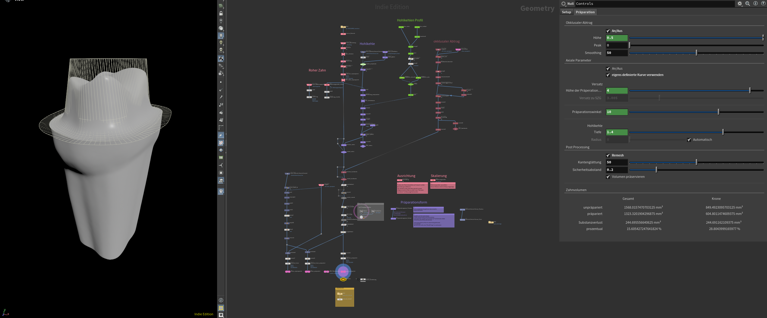 Overview of tooth preparation parameters in Houdini
